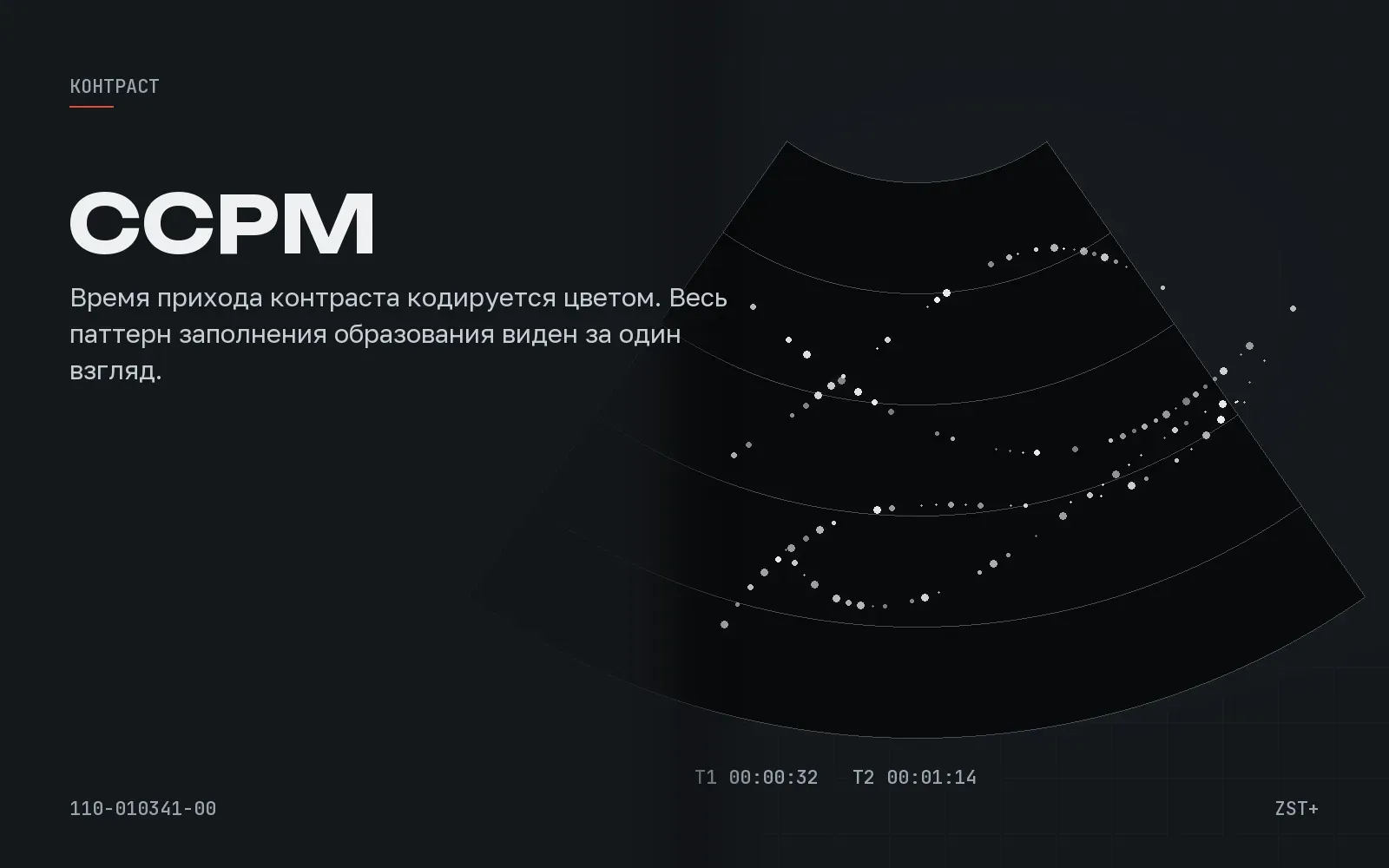 CEUS Chrono-Parametric Mode