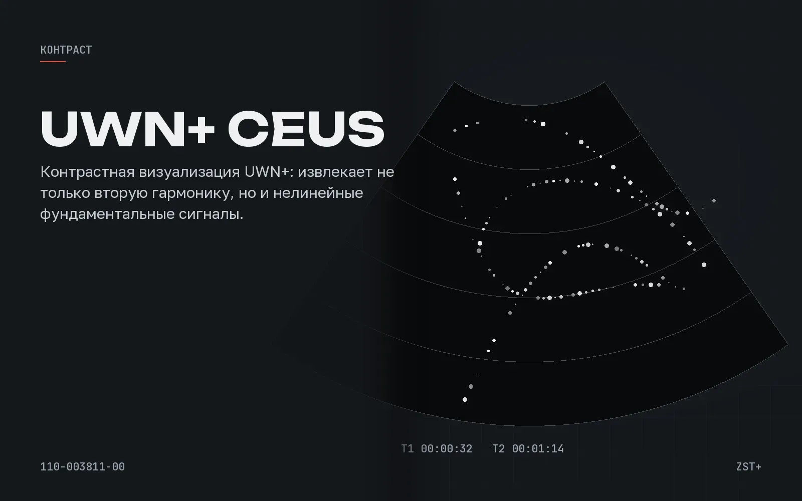 Contrast Imaging (UWN+), иллюстрация