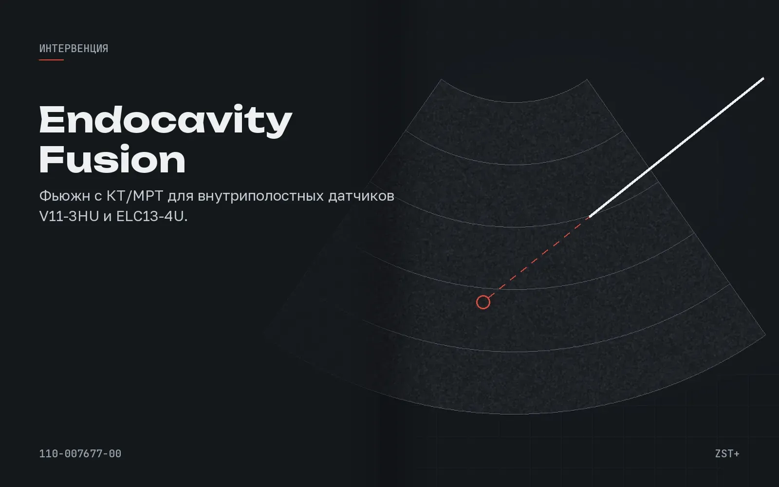 Endocavity Fusion Imaging