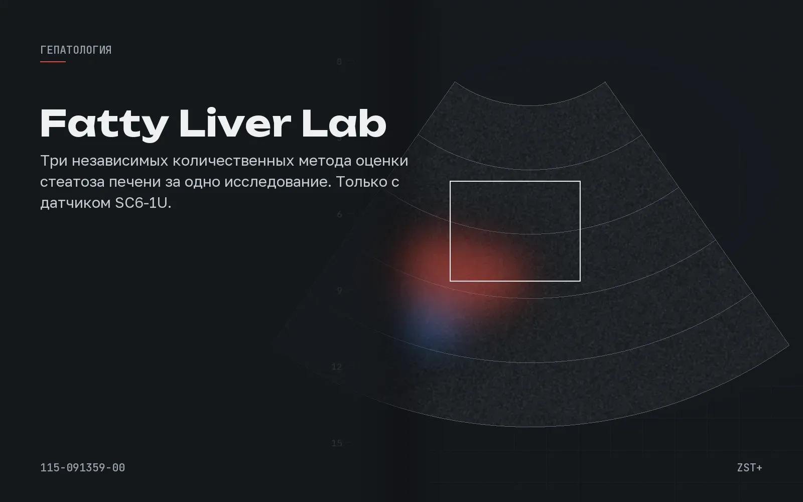 Fatty Liver Lab: три числа о стеатозе печени за одно исследование