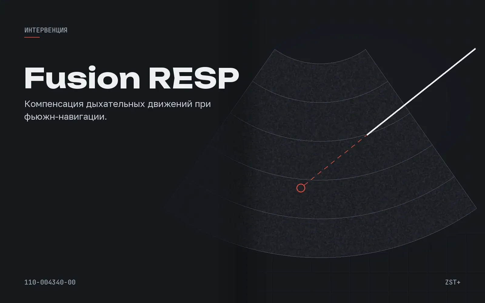 Fusion RESP