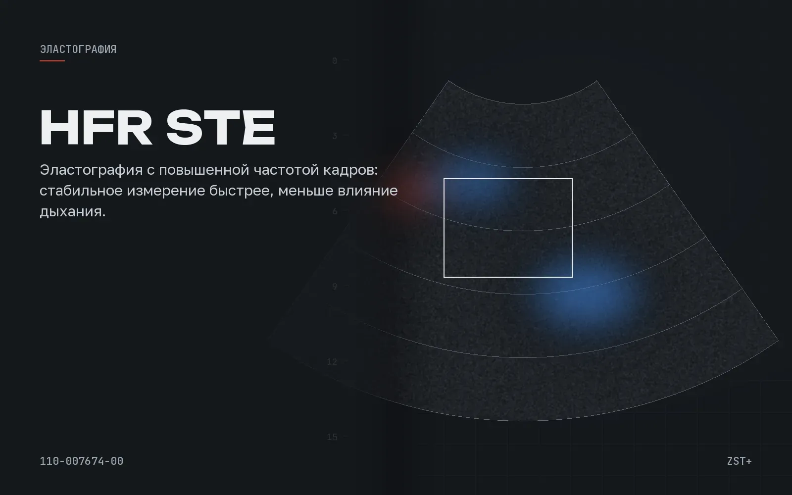High Frame Rate STE