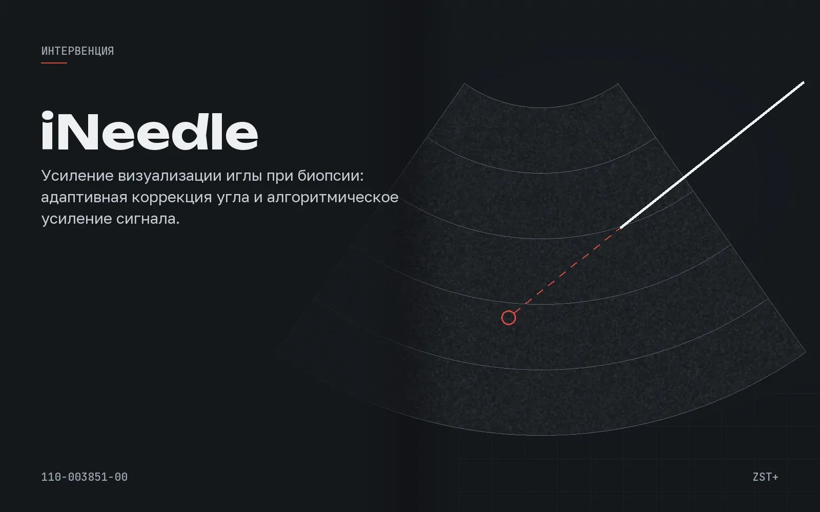 iNeedle