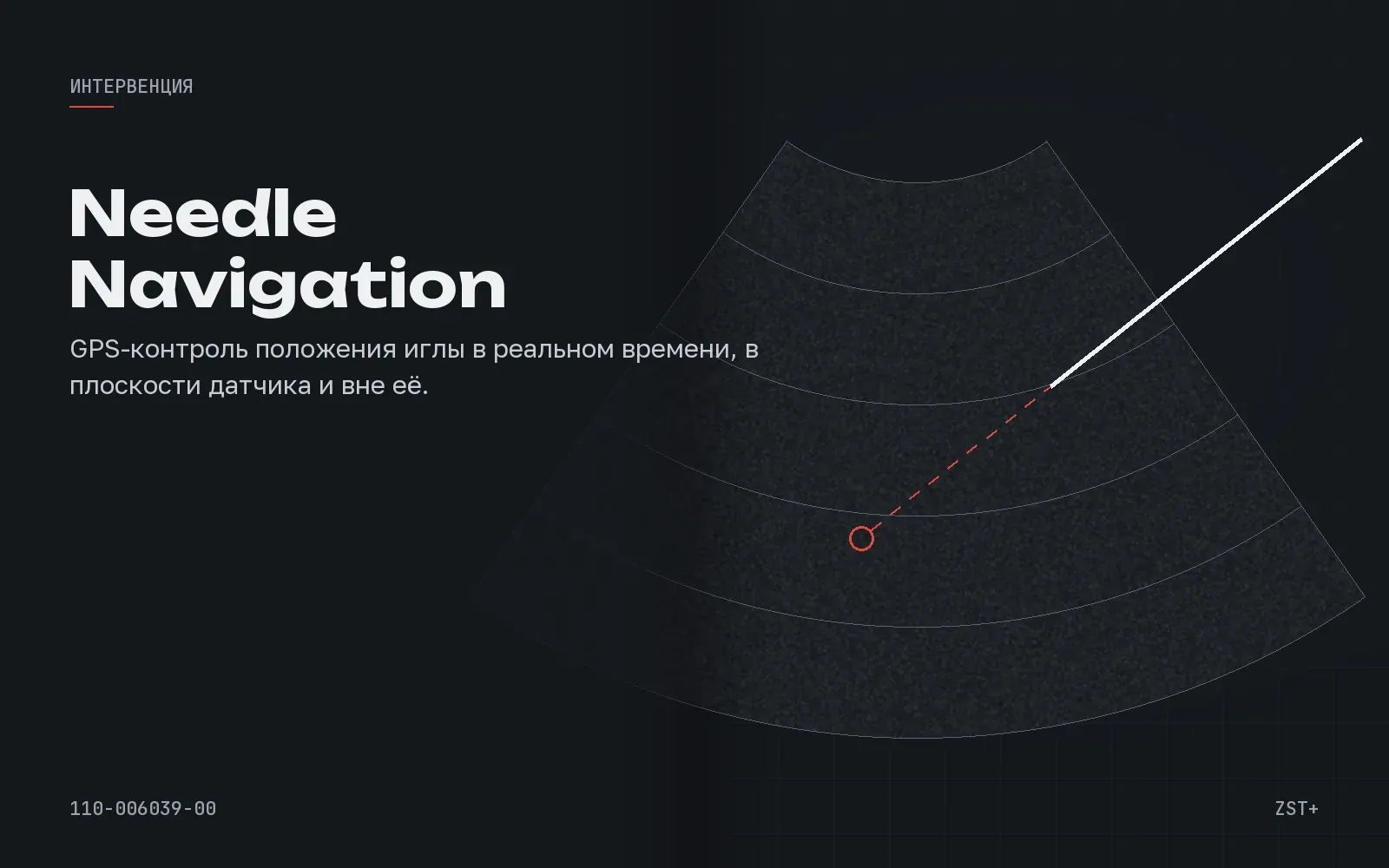 Needle Navigation