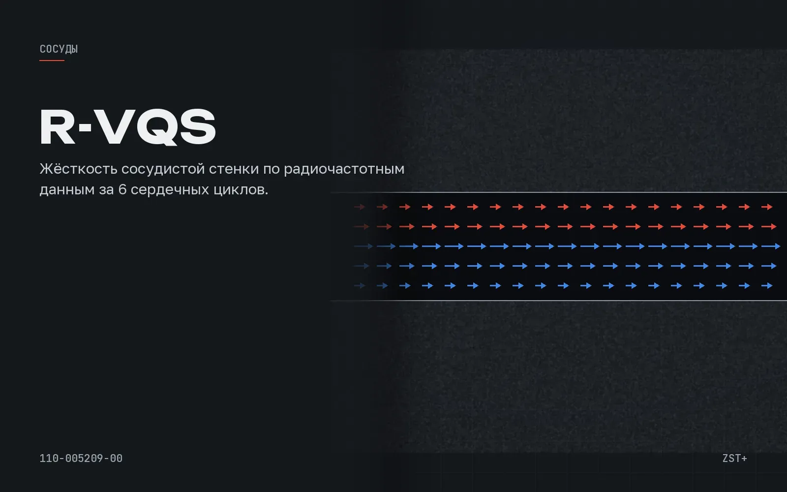 R-VQS