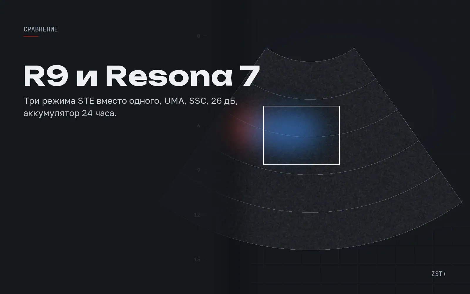 Resona R9 и Resona I9: R-серия и I-серия Mindray, в чём разница для отделения