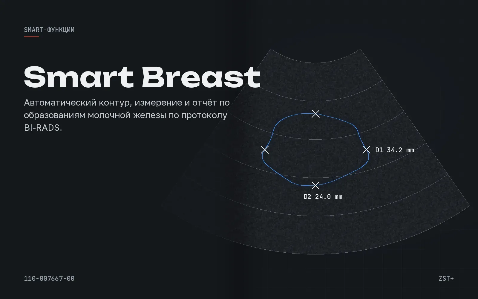 Smart Breast, иллюстрация