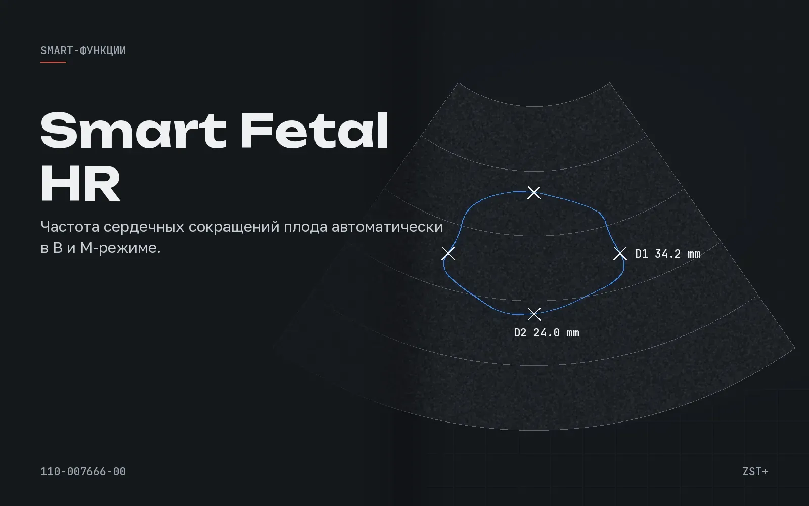 Smart Fetal HR