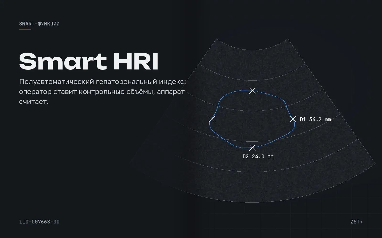 Smart HRI