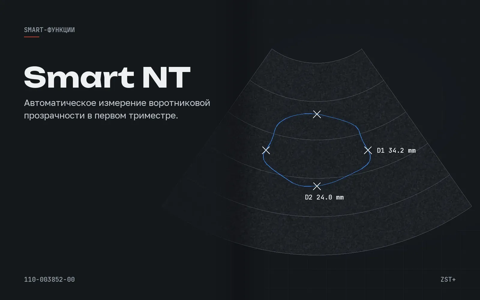 Smart NT
