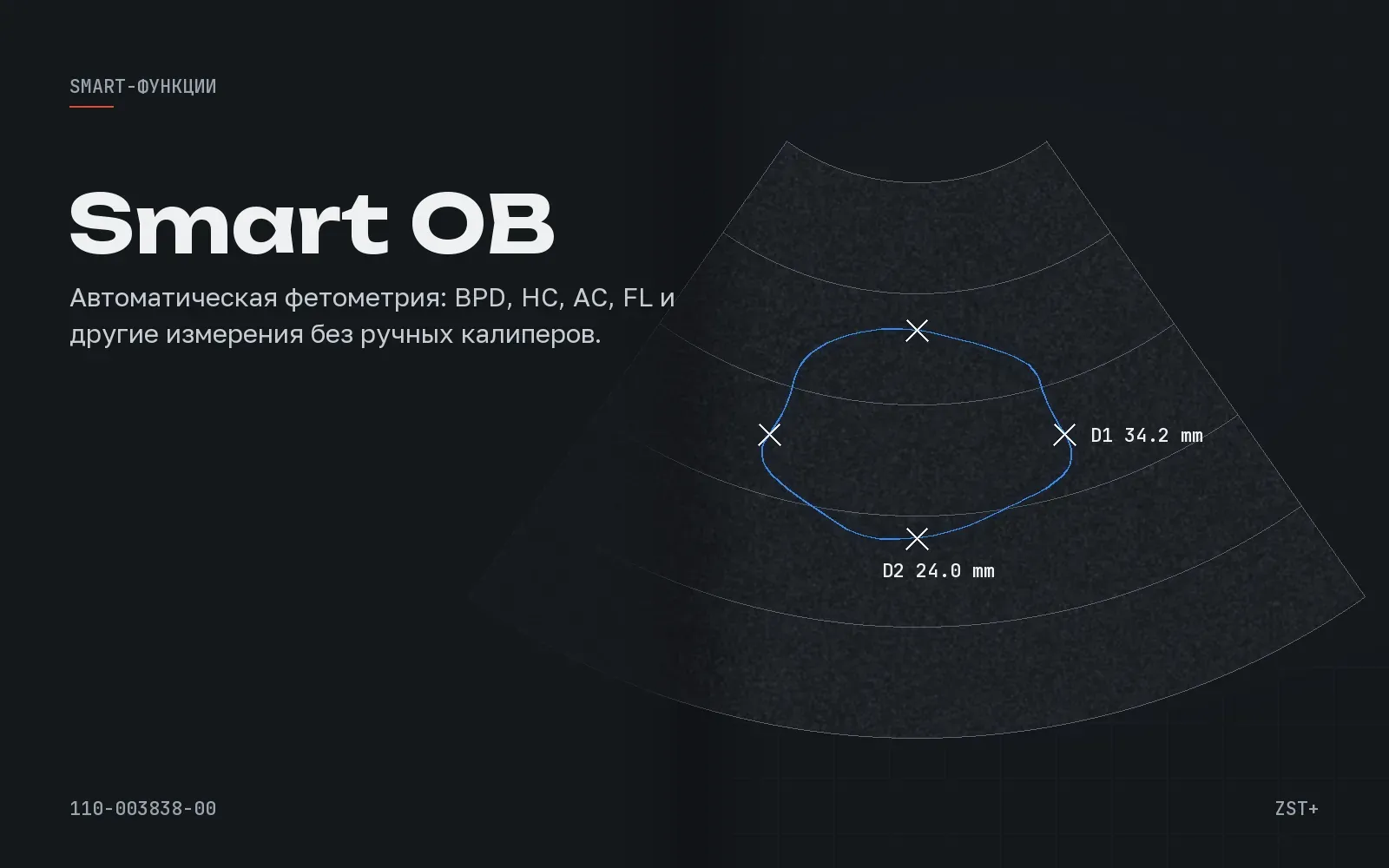 Smart OB