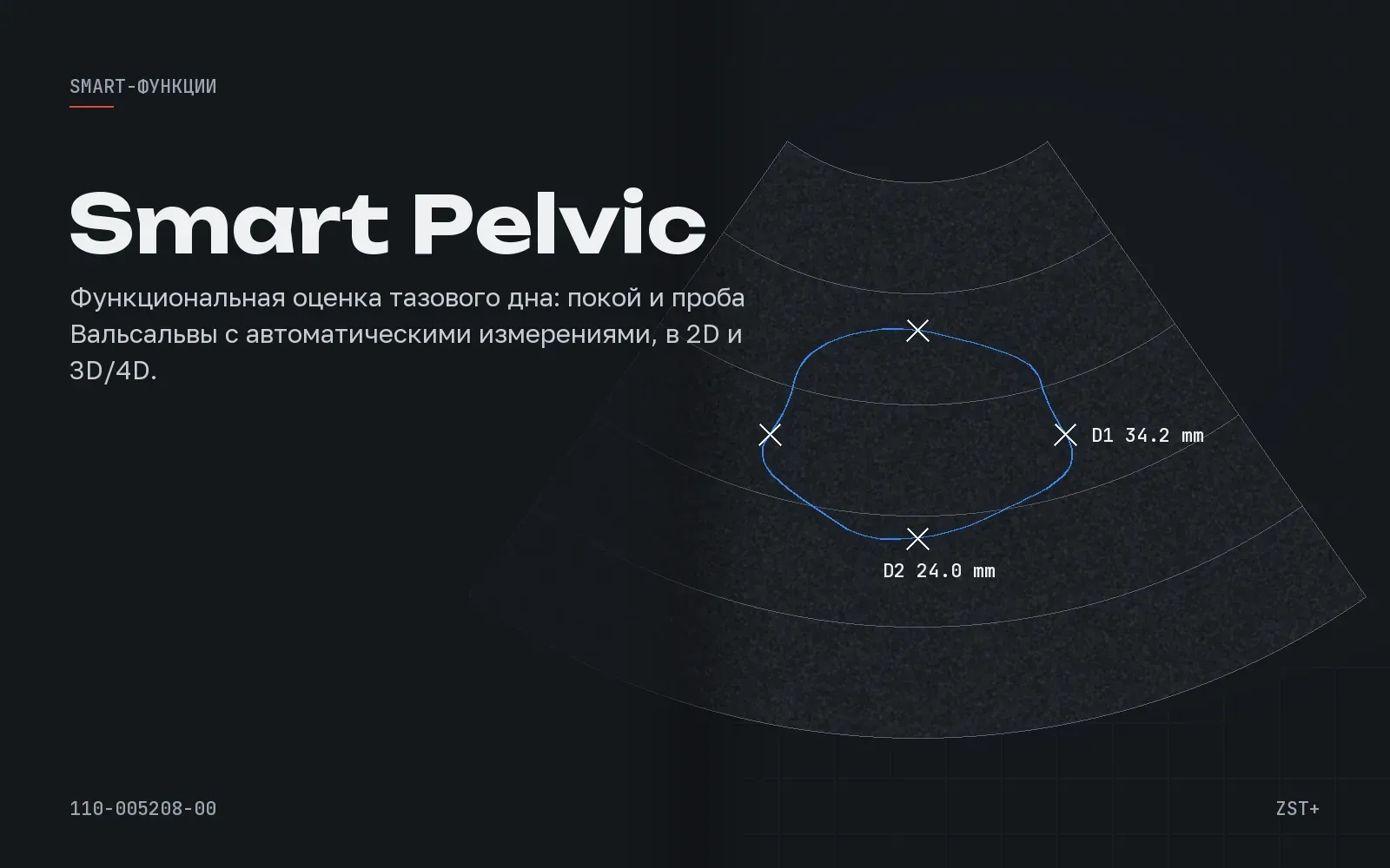 Smart Pelvic