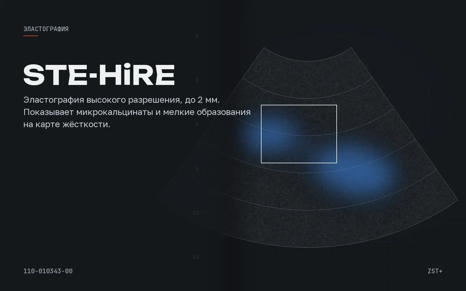 STE-HiRE