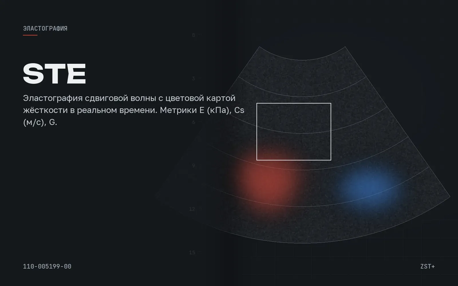STE (Sound Touch Elastography), иллюстрация