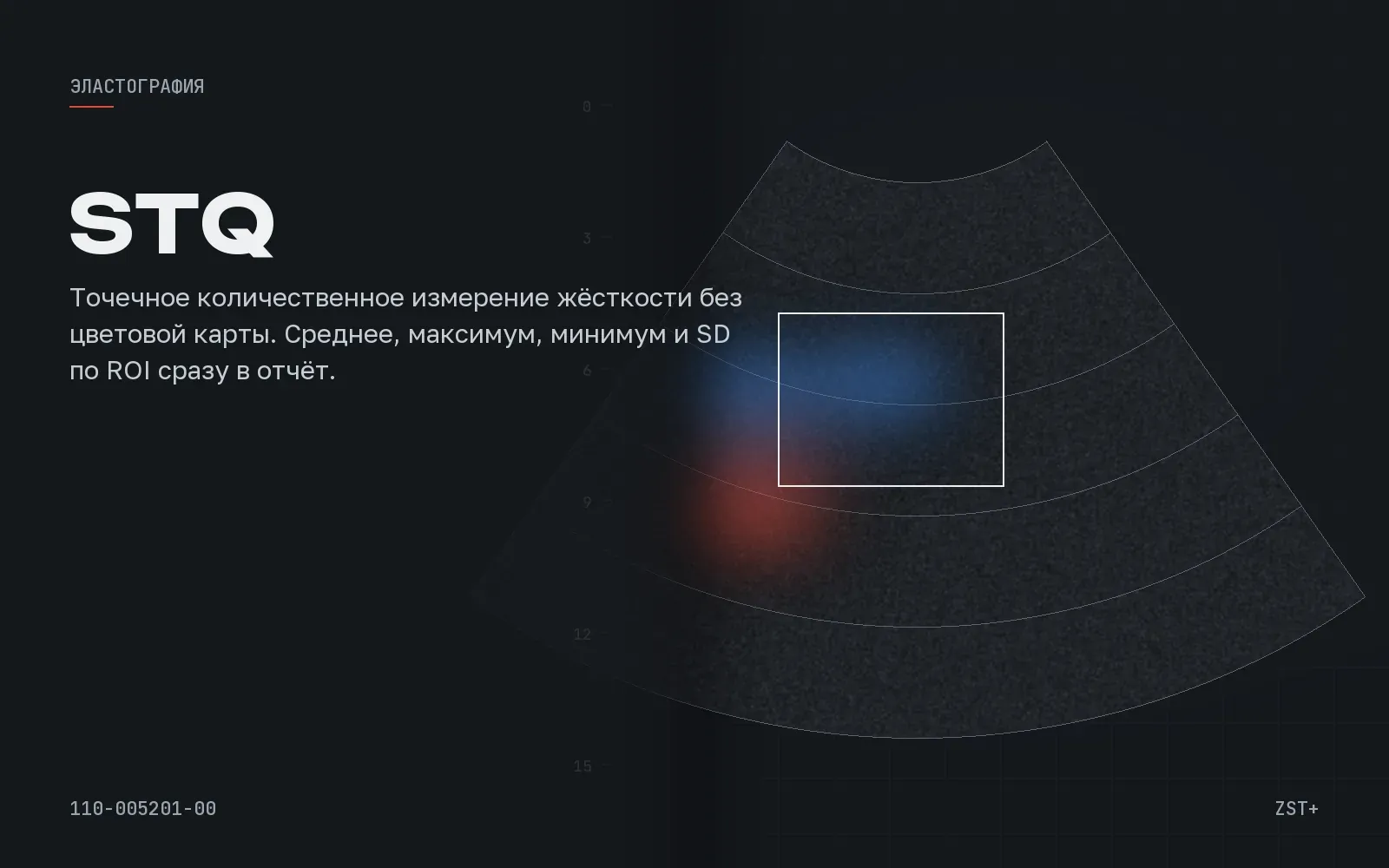 STQ (Sound Touch Quantification)