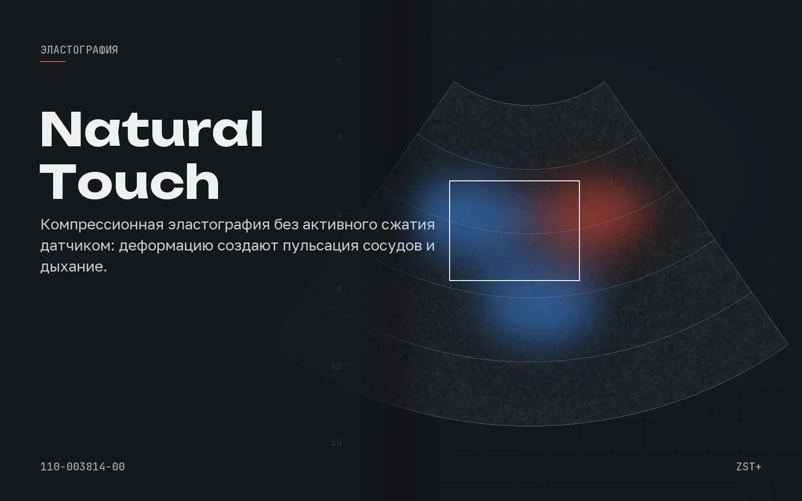 Strain Elastography (Natural Touch)