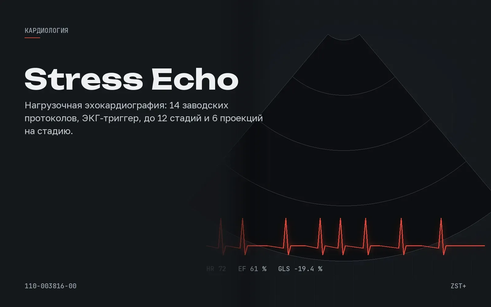 Стресс эхо-КГ: что это такое, как проводится и что требуется от аппарата