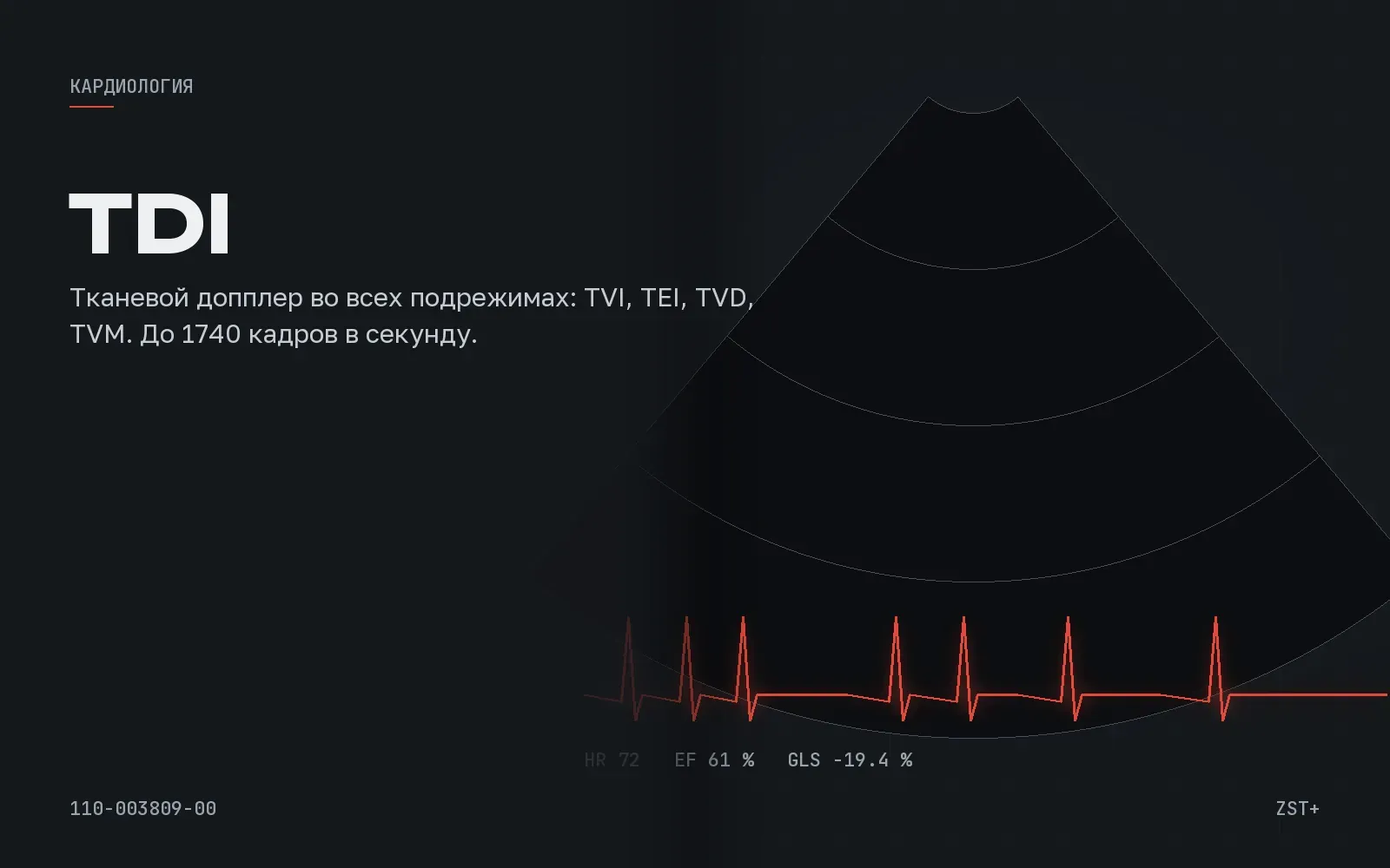 Tissue Doppler Imaging (TDI)