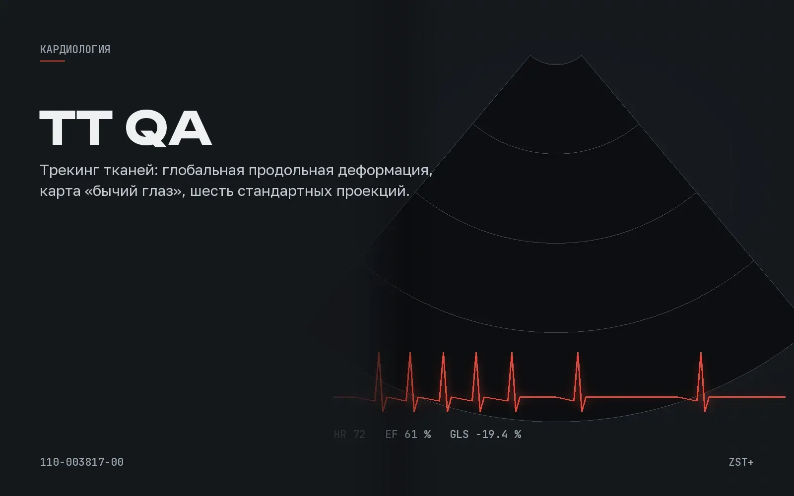 УЗИ аппарат для кардиологии: что должно быть в спецификации, чтобы кабинет работал