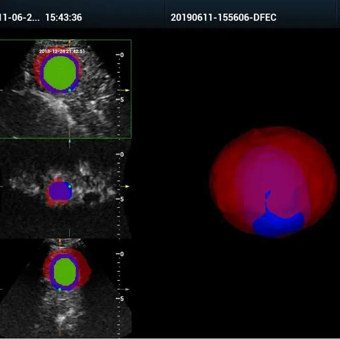 iFusion (Fusion Imaging Kit)