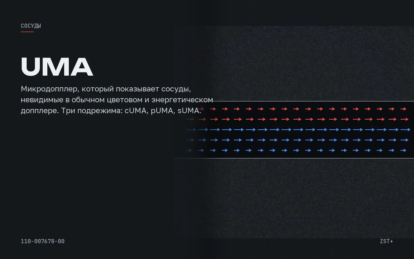 UMA: микрососуды образования без контрастного препарата