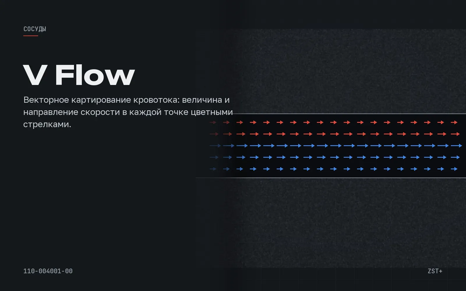 V Flow, иллюстрация