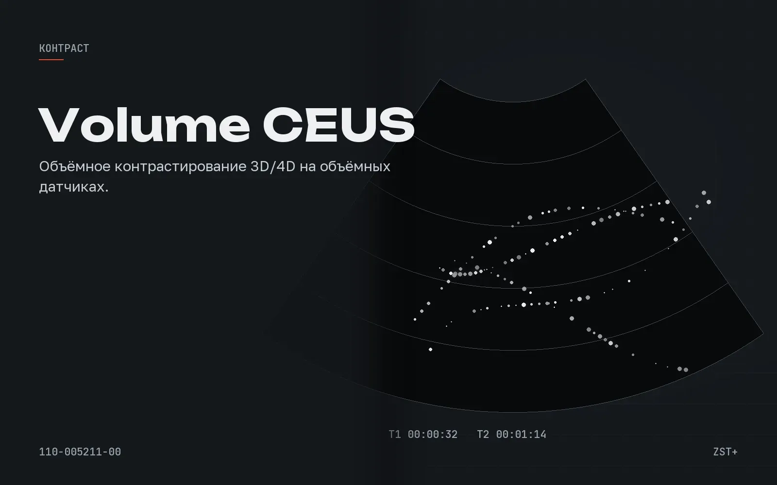 Volume CEUS
