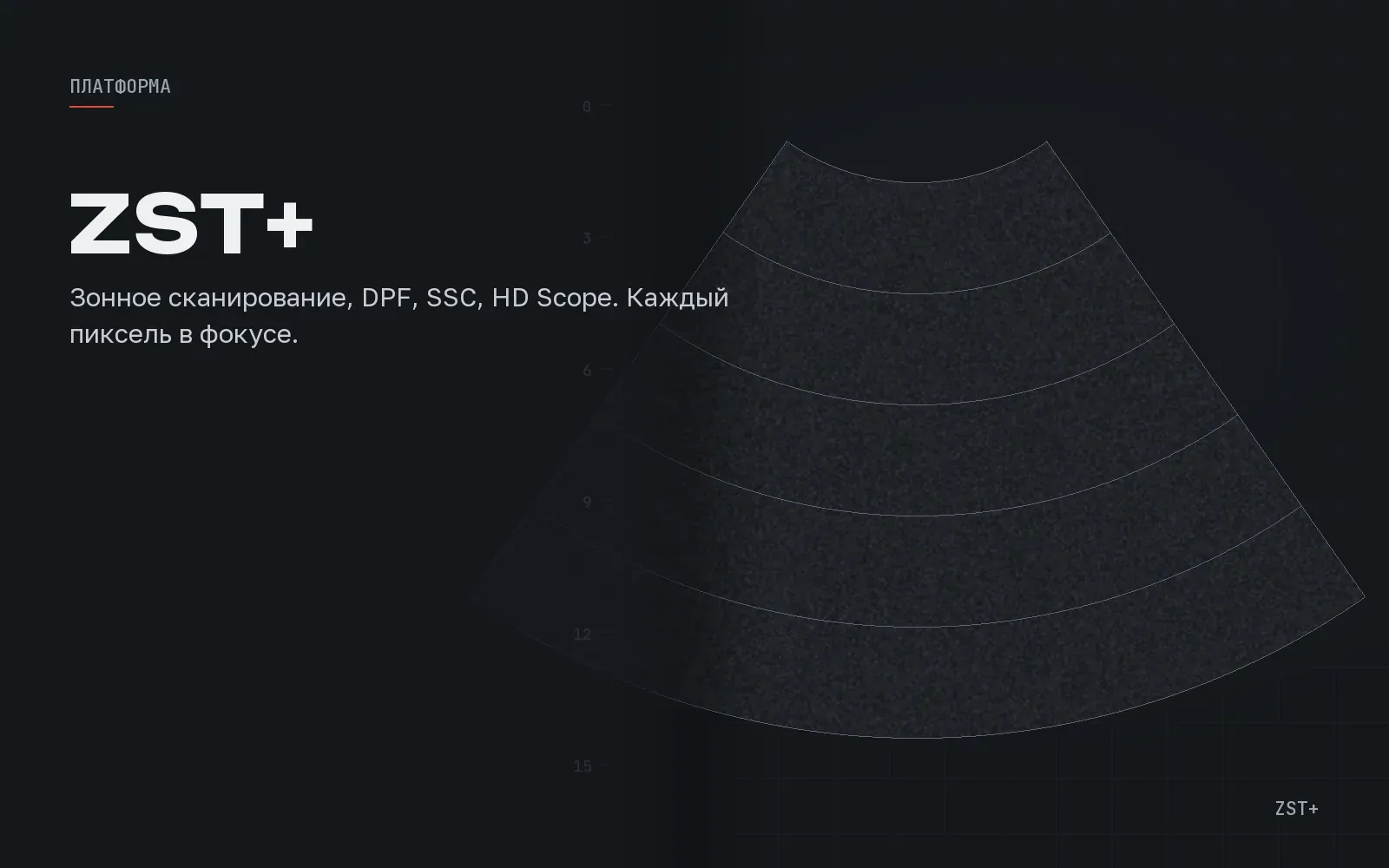SSC: почему Resona R9 подбирает скорость звука под каждого пациента